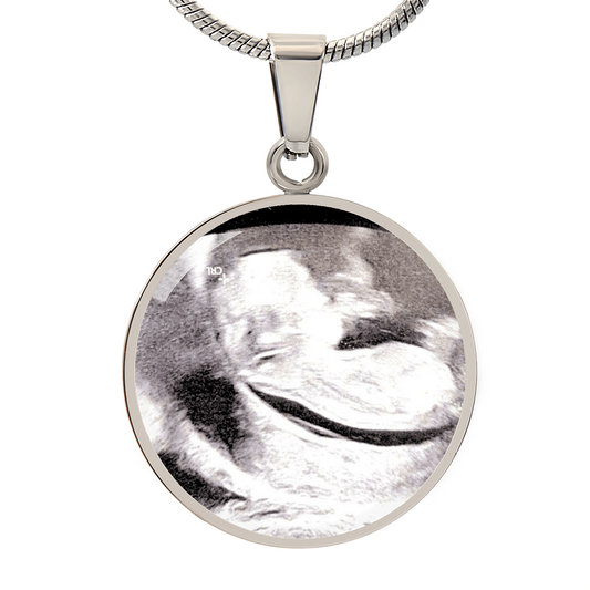 02062026 Sonogram