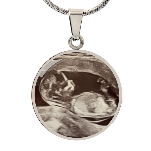 Sonogram 07172026