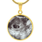 Ultrasound Necklace 08212025
